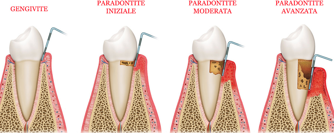 parodontologia1.jpg