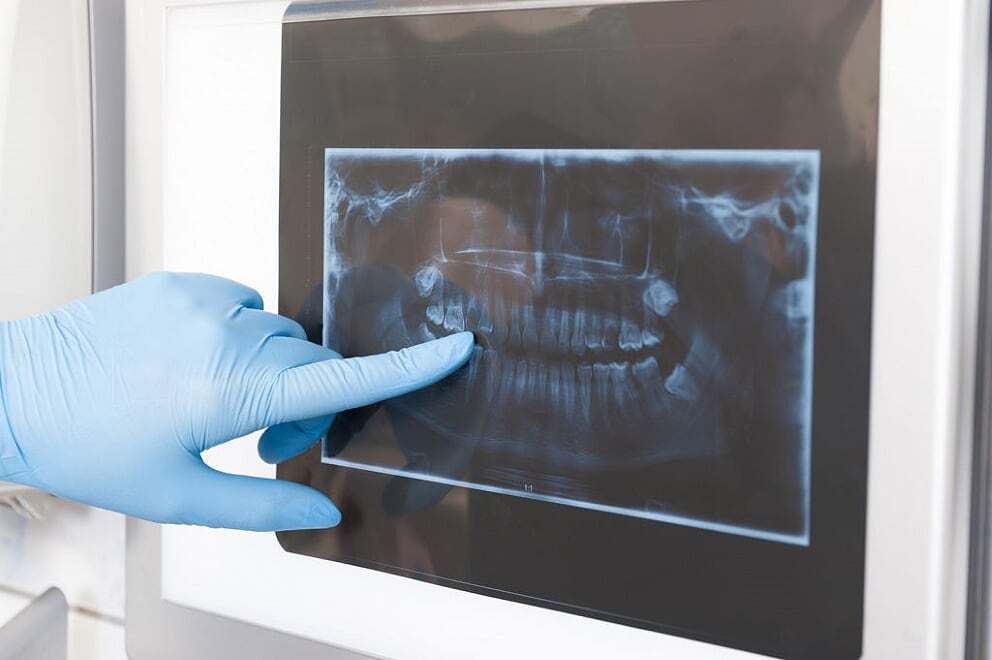 3 esame radiologico