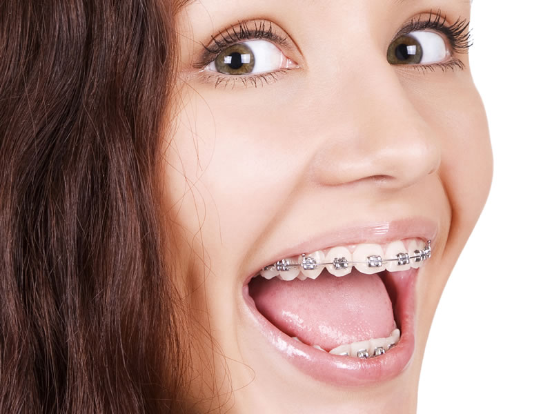 apparecchio denti torino 02