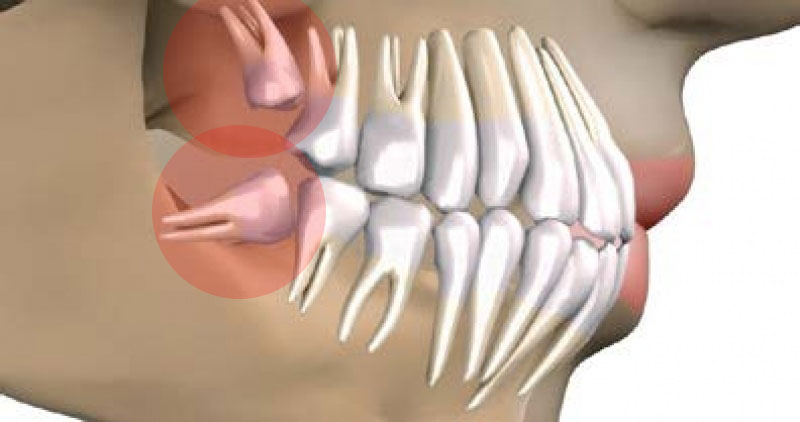 dente del giudizio